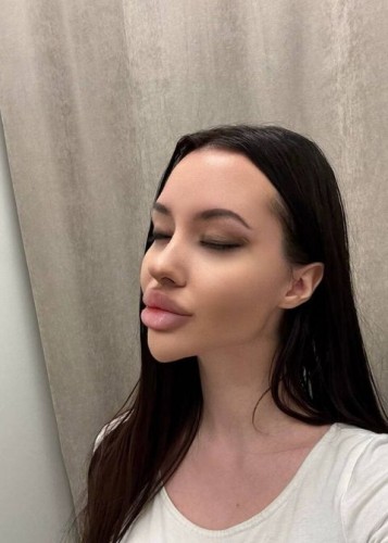 Лисса, Г. Хороль